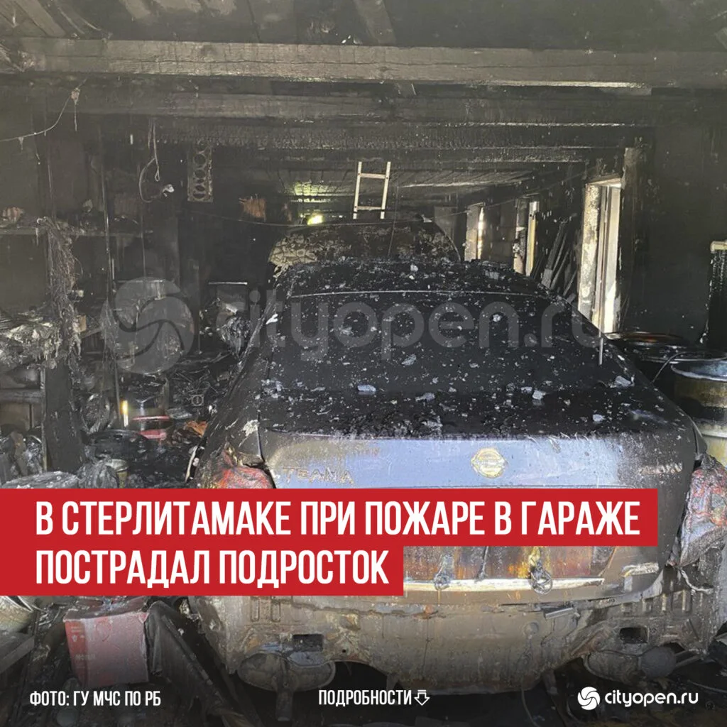 В Стерлитамаке при пожаре в гараже пострадал подросток