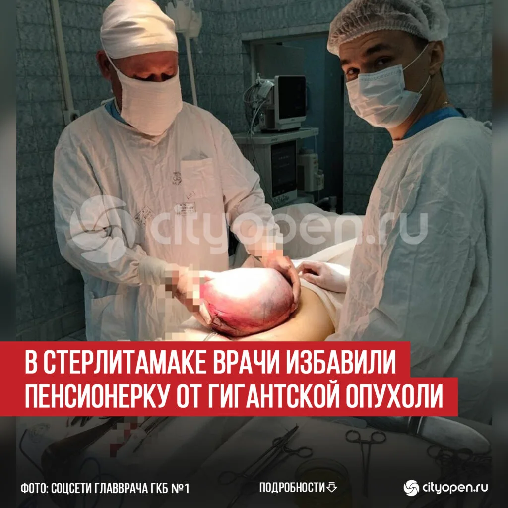 В Стерлитамаке врачи избавили пенсионерку от гигантской опухоли
