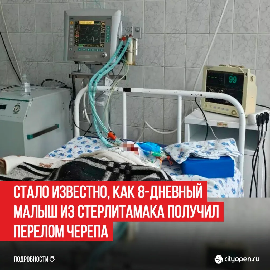 Стало известно, как 8-дневный малыш из Стерлитамака получил перелом черепа