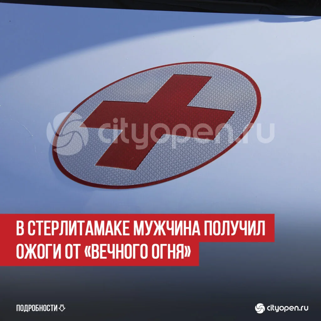В Стерлитамаке мужчина получил ожоги от «Вечного огня»