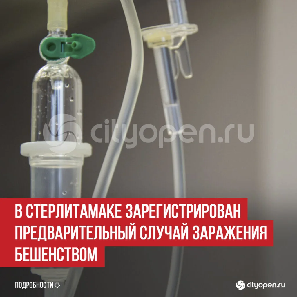 В Стерлитамаке зарегистрирован предварительный случай заражения бешенством