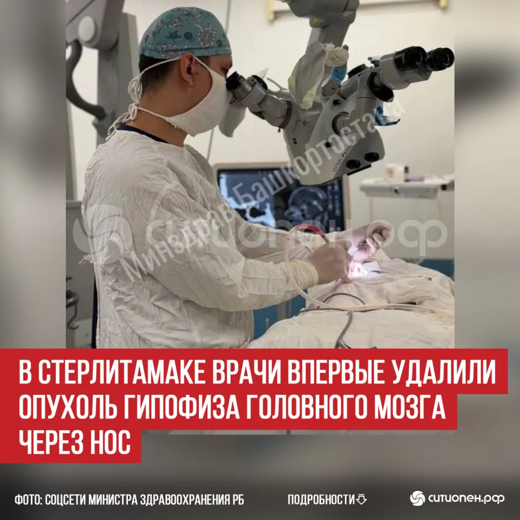 В Стерлитамаке врачи впервые удалили опухоль гипофиза головного мозга через нос