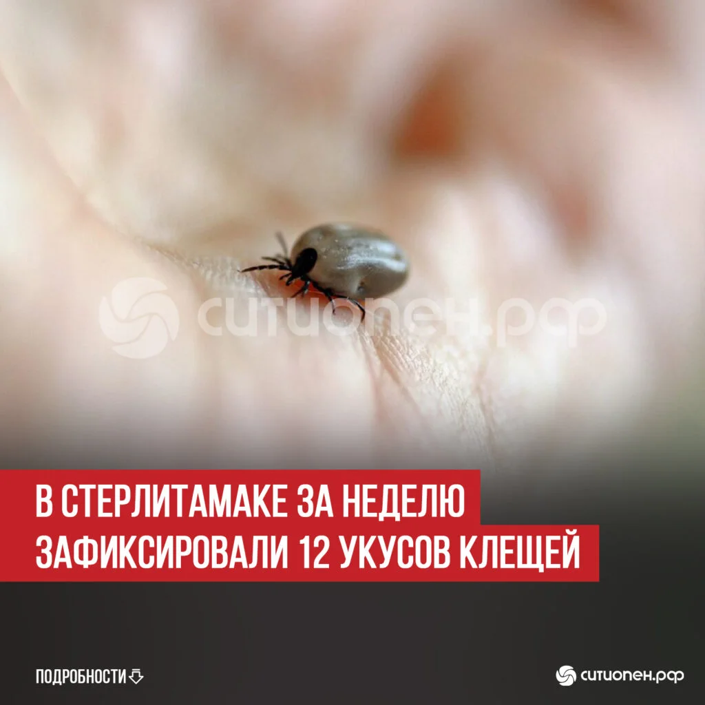 В Стерлитамаке за неделю зафиксировали 12 укусов клещей