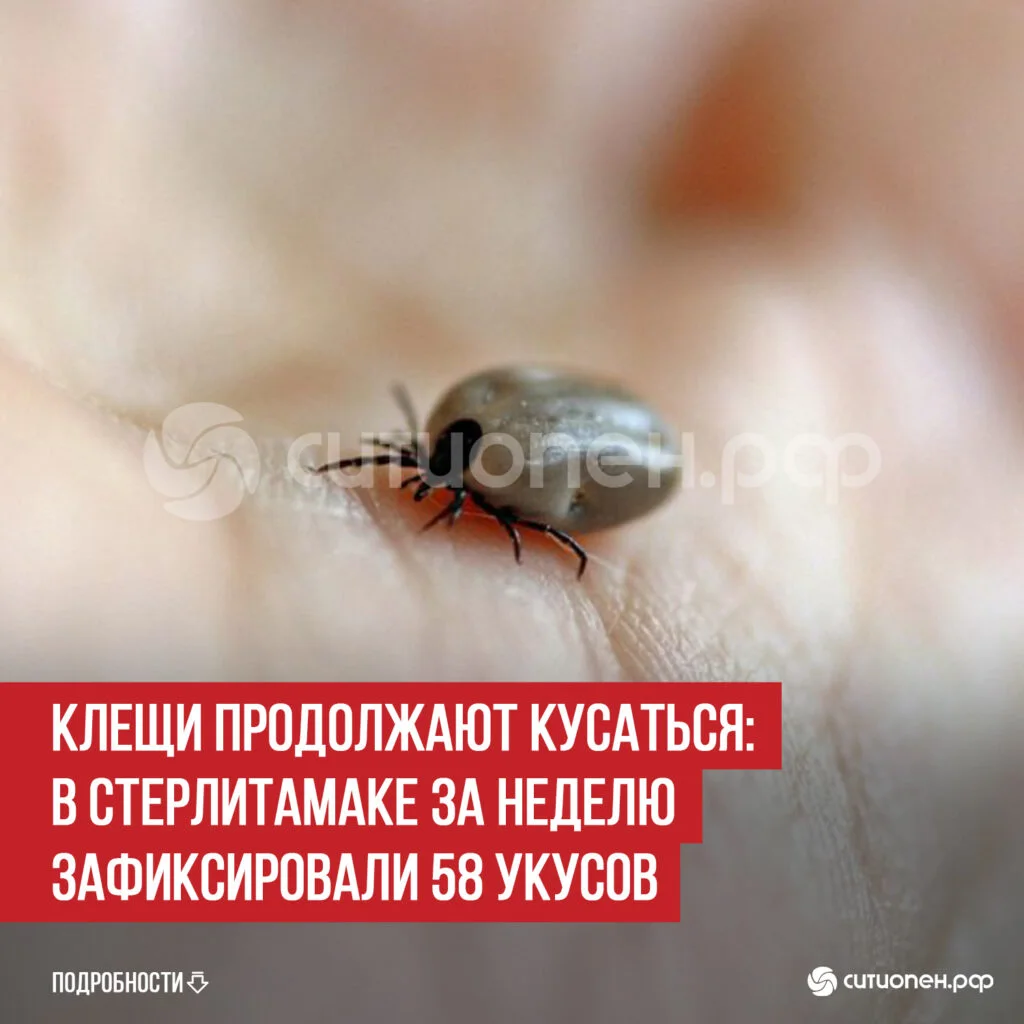 Клещи продолжают кусаться: в Стерлитамаке за неделю зафиксировали 58 укусов