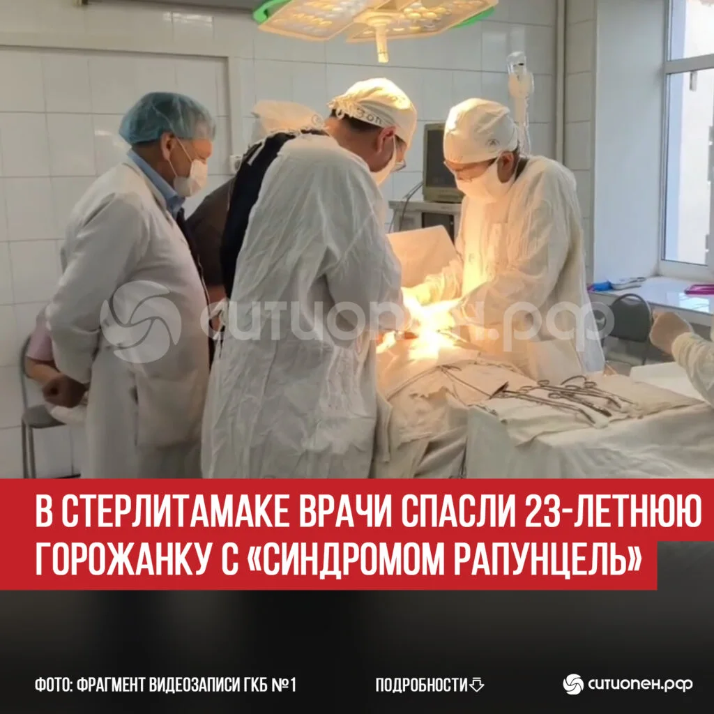 В Стерлитамаке врачи спасли 23-летнюю горожанку с «синдромом Рапунцель»