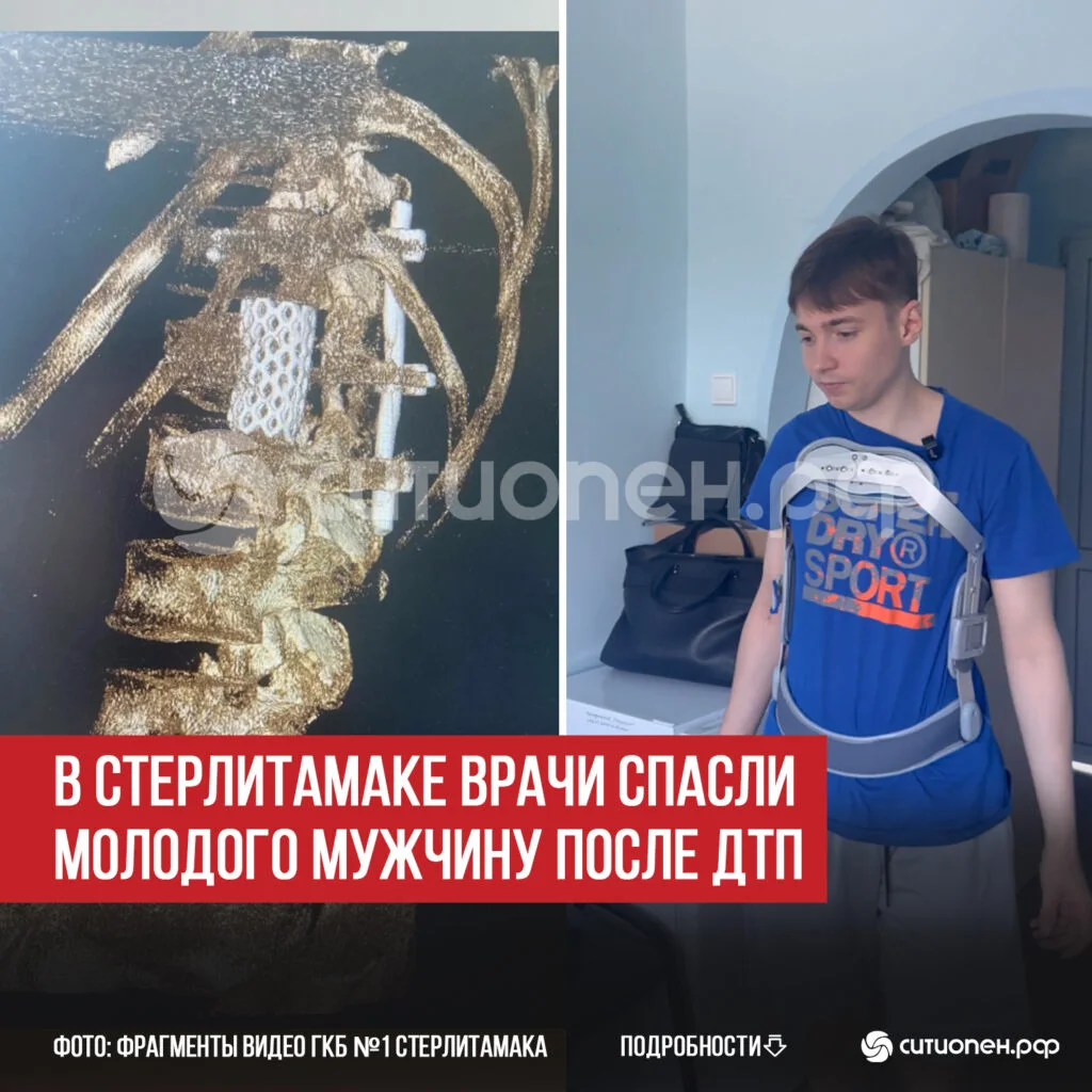 В Стерлитамаке врачи спасли молодого мужчину после ДТП